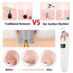 Electric Blackhead Remover – 5-Head Vacuum Suction for Acne, Pores & Skin Care - Image 5